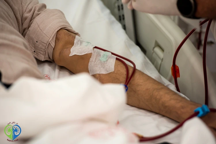 افضل مراكز غسيل الكلى بالقاهرة